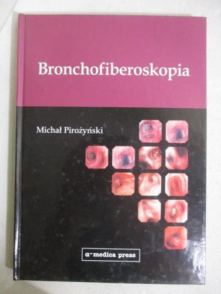 Bronchofiberoskopia