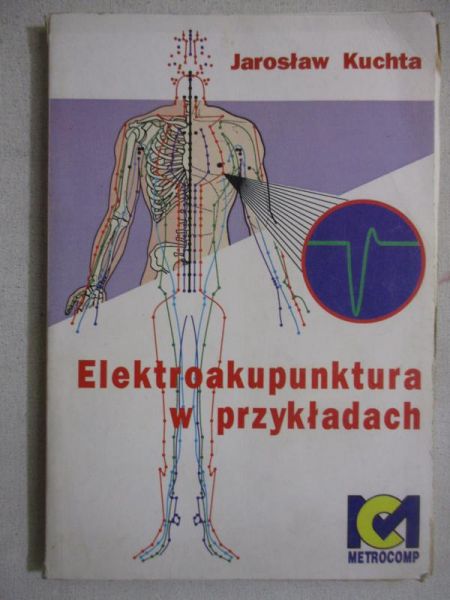Kuchta Jarosław - Elektroakupunktura w przykładach