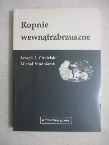 Ropnie wewnątrzbrzuszne