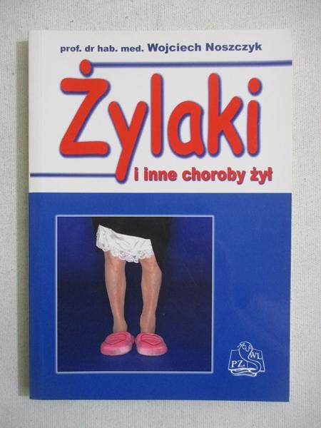Żylaki i inne choroby żył