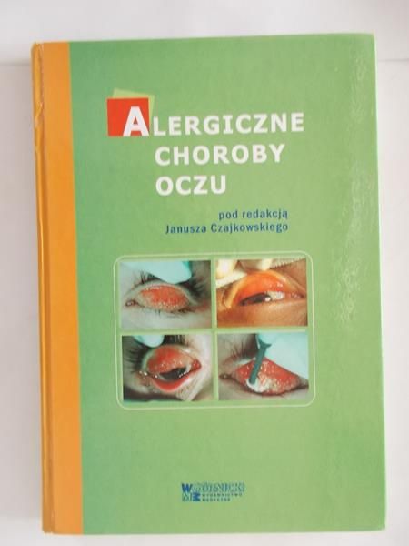 Alergiczne choroby oczu