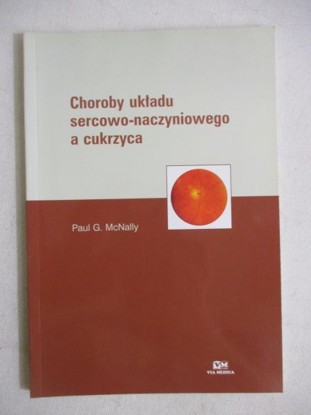 Choroby układu sercowo-naczyniowego a cukrzyca