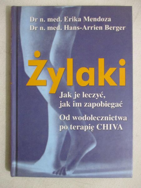 Żylaki