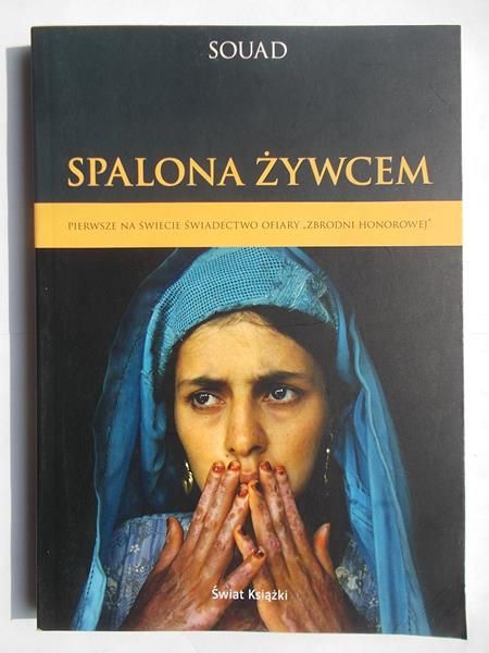 Spalona żywcem
