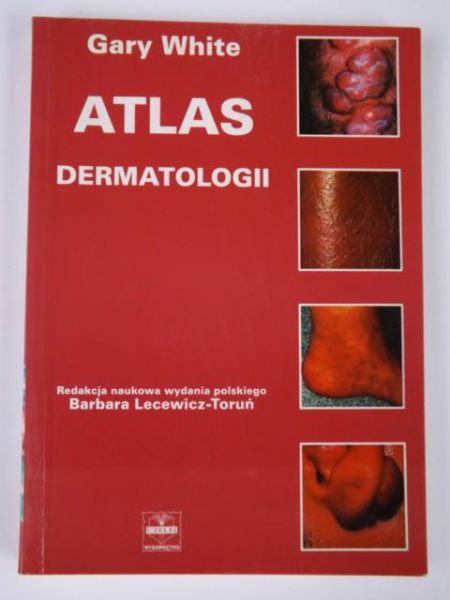 Atlas dermatologii