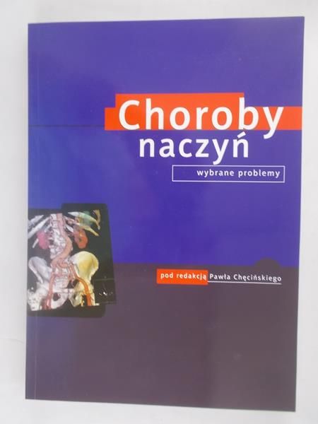 Choroby naczyń