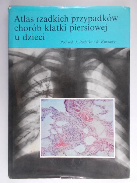 Rudnik J (red.) - Atlas rzadkich przypadków chorób klatki piersiowej u dzieci