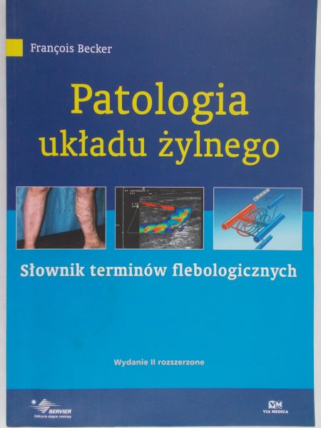 Patologia układu żylnego