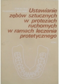 Ustawienia zębów sztucznych w protezach ruchomych w ramach leczenia protetycznego