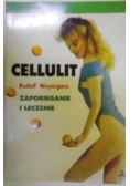 Cellulit zapobieganie i leczenie