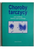 Choroby tarczycy