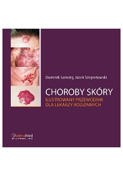 Choroby skóry