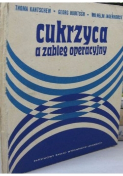 Cukrzyca a zabieg operacyjny