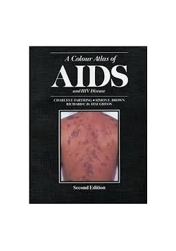 A Colour Atlas of AIDS and HIV Disease