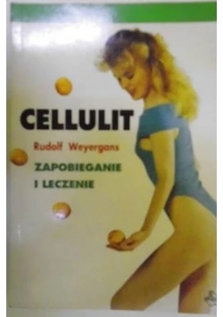 Cellulit zapobieganie i leczenie