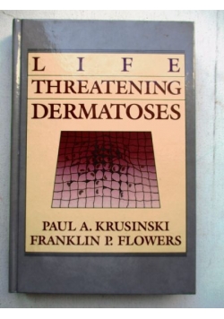 Life Threatening Dermatoes