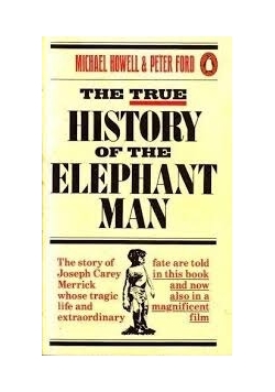 The true History od the Elephant Man
