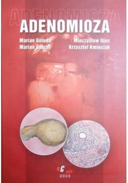 Adenomioza