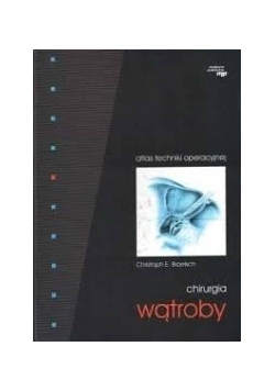 Atlas chirurgii operacyjnej - chirurgia wątroby