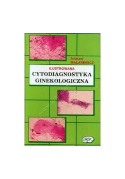 Cytodiagnostyka ginekologicznego