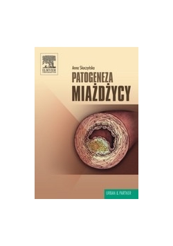 Patogeneza miażdżycy