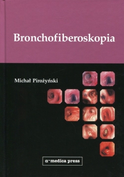 Bronchofiberoskopia